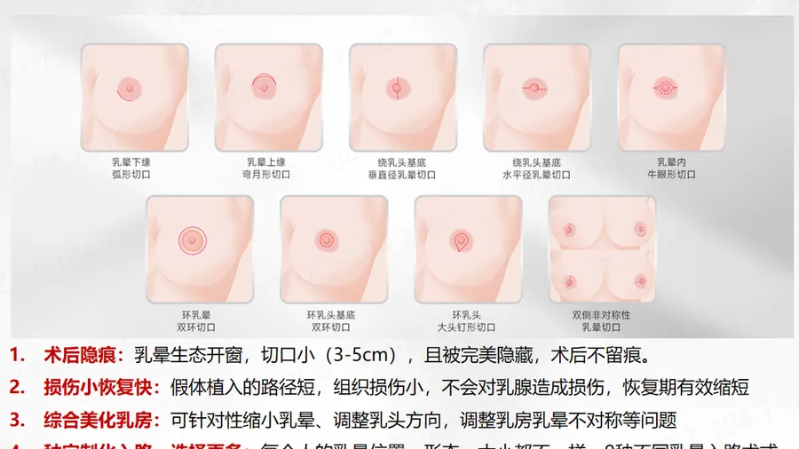 乳房基底宽度和下皱襞是什么？术前为什么要量这两个数