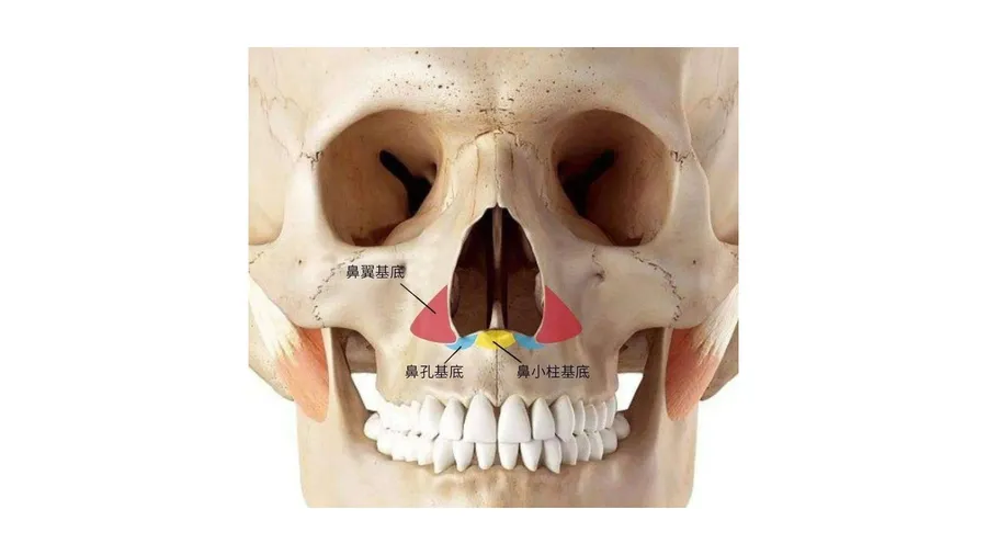 鼻基底凹陷是怎么回事？骨性凹陷和软组织不足怎么区分